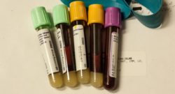 Scientists develop blood test that reveals how fast your organs are aging